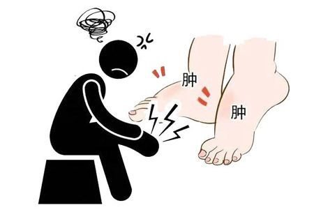 Qigong online para edemas